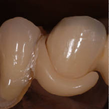 Dental-D Azetal